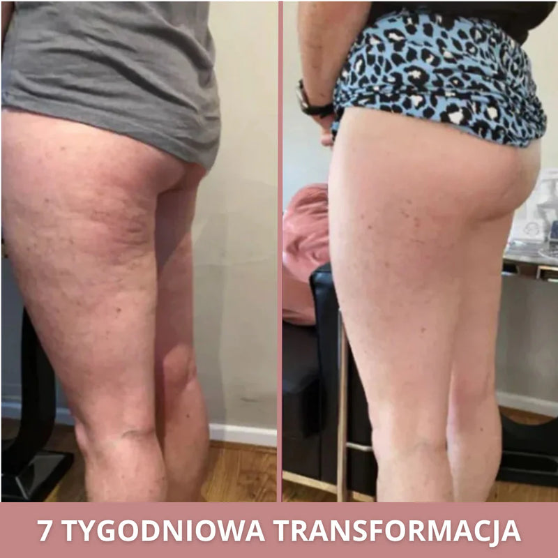 Anna (36 ans)